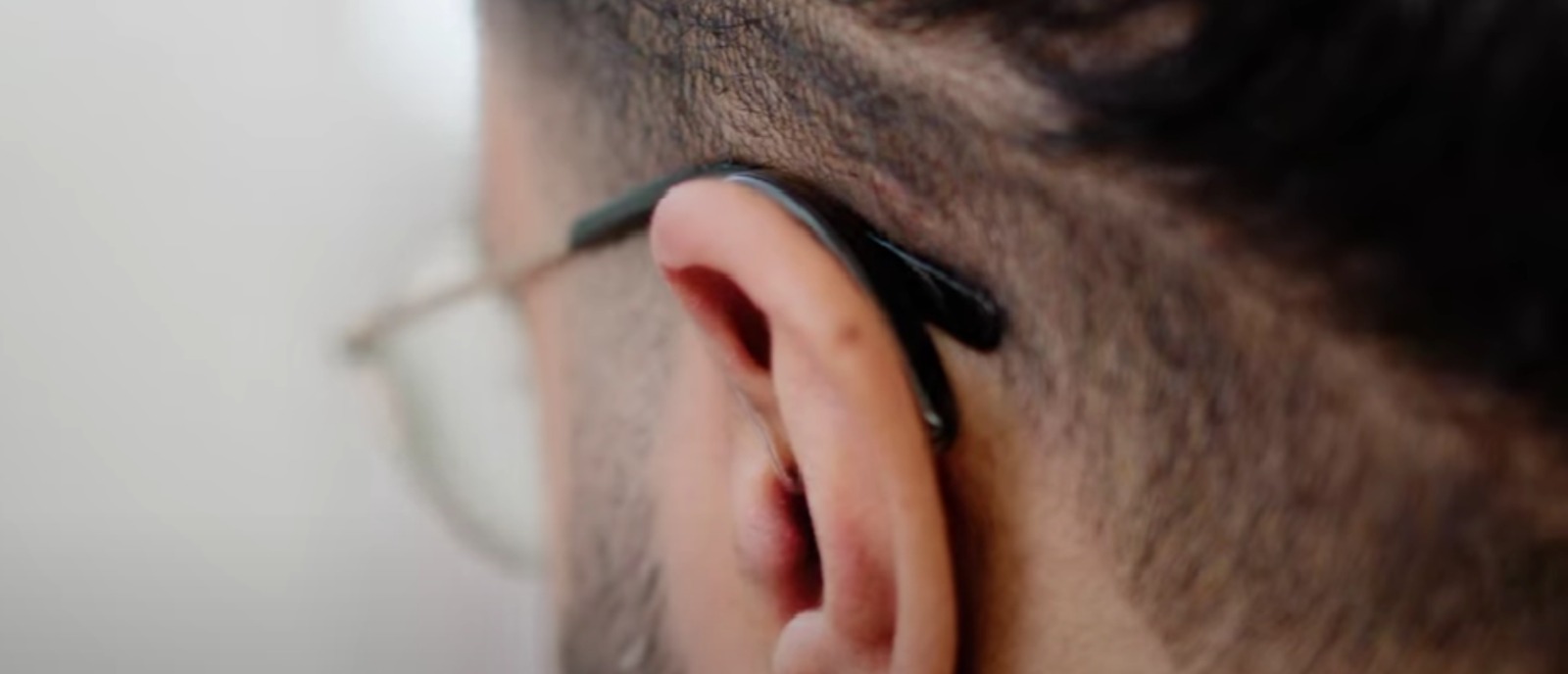 Hearing aids help manage tinnitus by amplifying ambient sounds and reducing the perception of ringing.